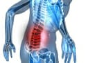 sciatique : comment la diagnostiquer ?